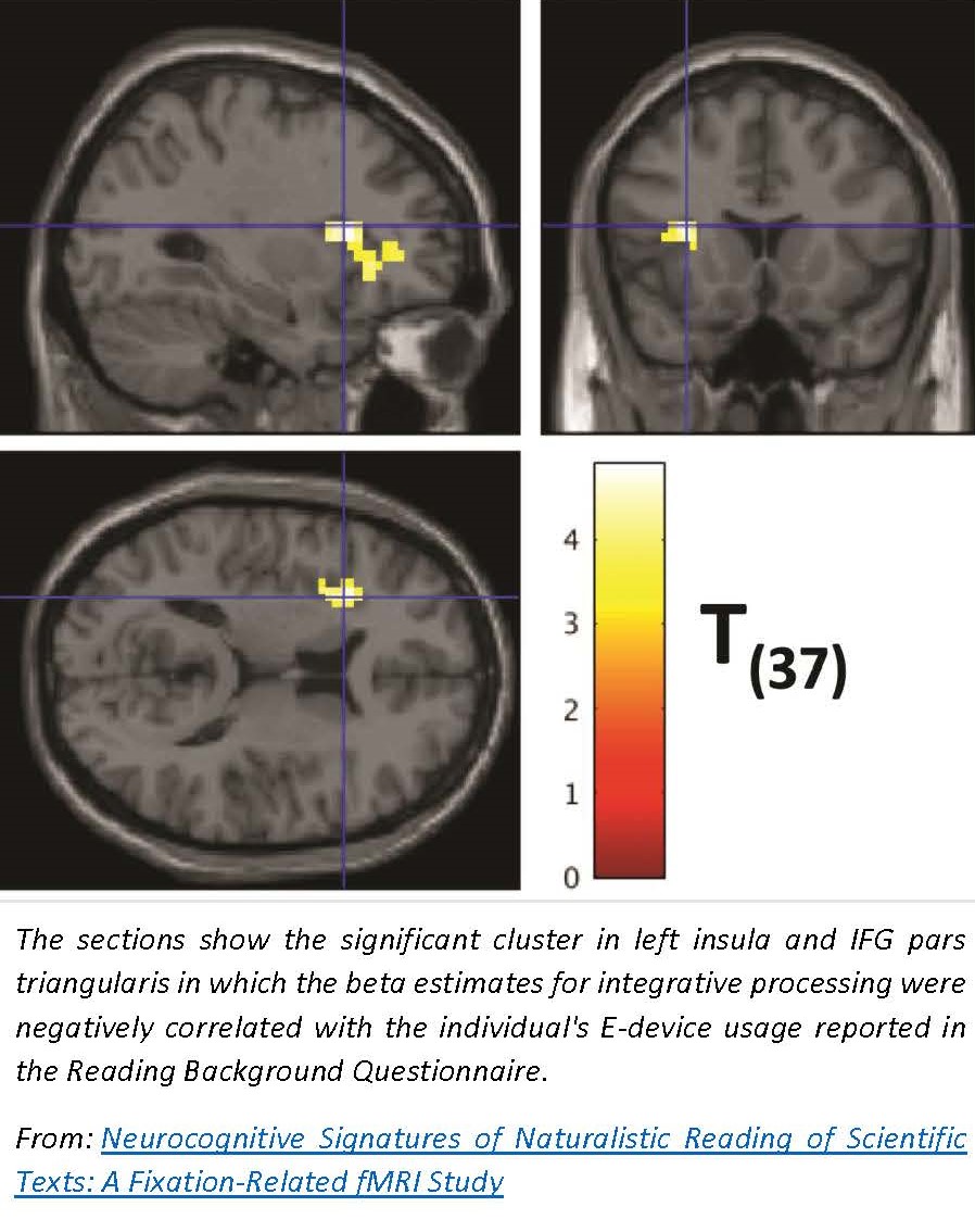 ScientificText_brain