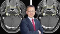 AI technology enables contrast-free MRI procedures 